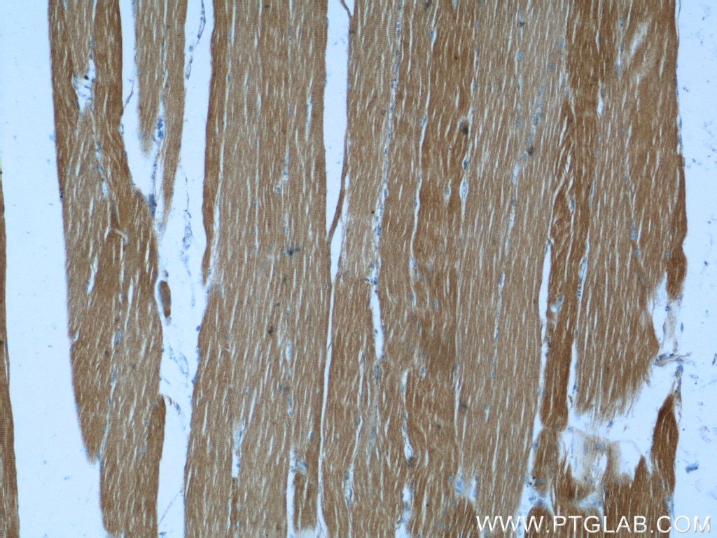 Immunohistochemistry (IHC) staining of human skeletal muscle tissue using RTN2 Polyclonal antibody (11168-1-AP)