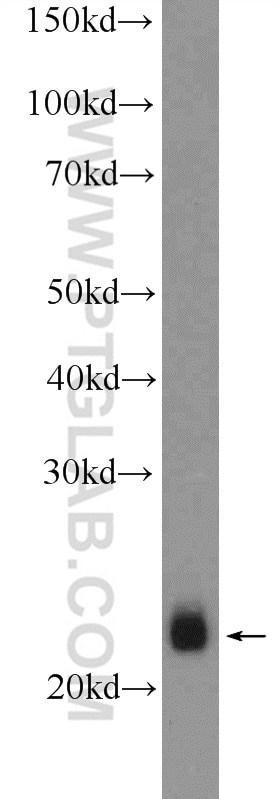 Western Blot (WB) analysis of mouse skeletal muscle tissue using RTN2 Polyclonal antibody (11168-1-AP)