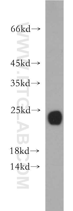 Western Blot (WB) analysis of human skeletal muscle tissue using RTN2 Polyclonal antibody (11168-1-AP)