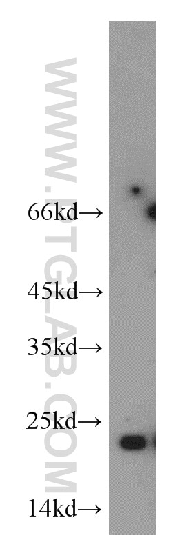 Western Blot (WB) analysis of mouse skeletal muscle tissue using RTN2 Polyclonal antibody (11168-1-AP)