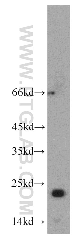 Western Blot (WB) analysis of mouse skeletal muscle tissue using RTN2 Polyclonal antibody (11168-1-AP)