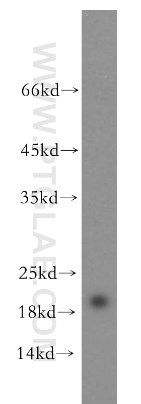 Western Blot (WB) analysis of human skeletal muscle tissue using RTN2 Polyclonal antibody (11168-1-AP)