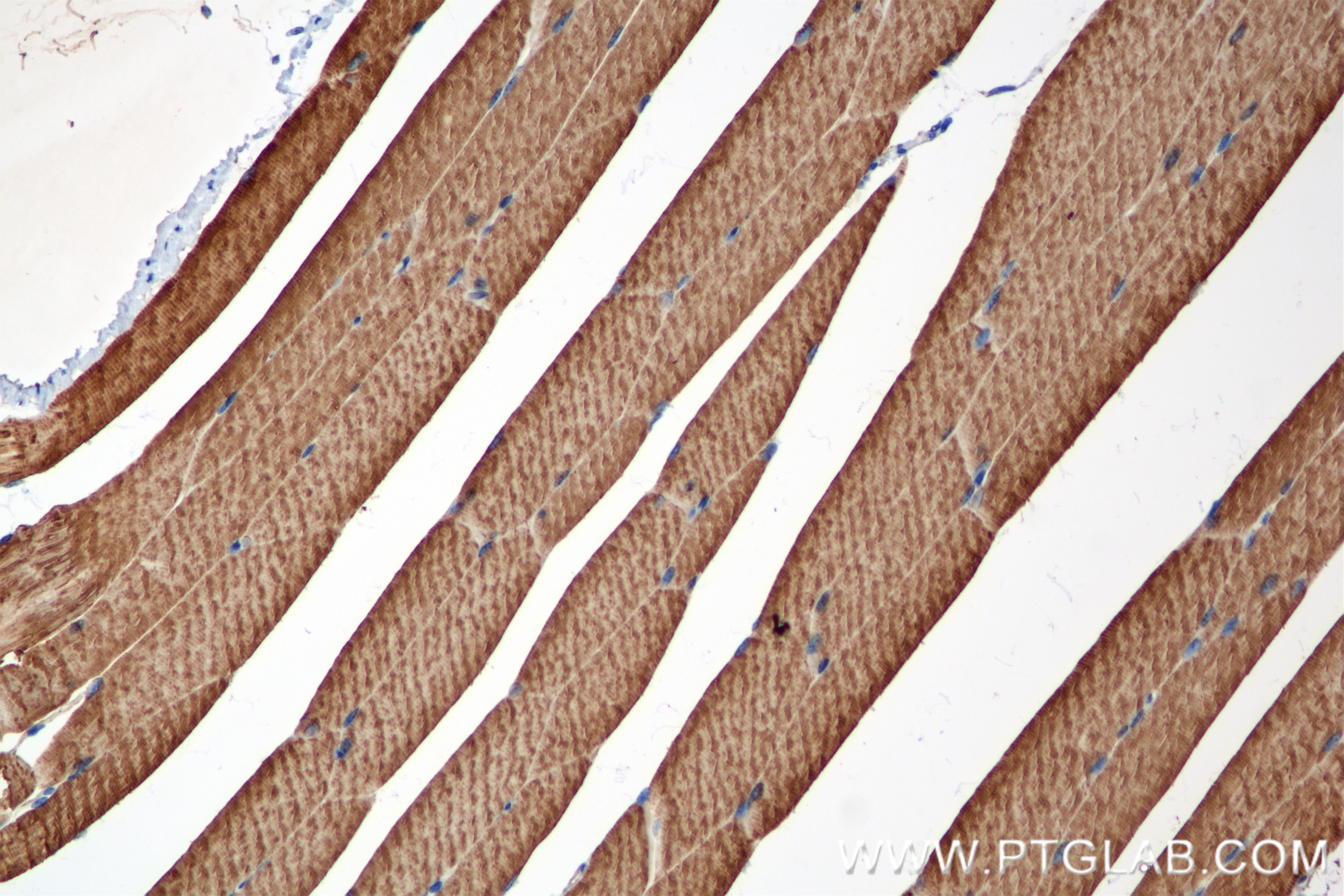 Immunohistochemistry (IHC) staining of mouse skeletal muscle tissue using RTN2 Recombinant antibody (86162-1-RR)