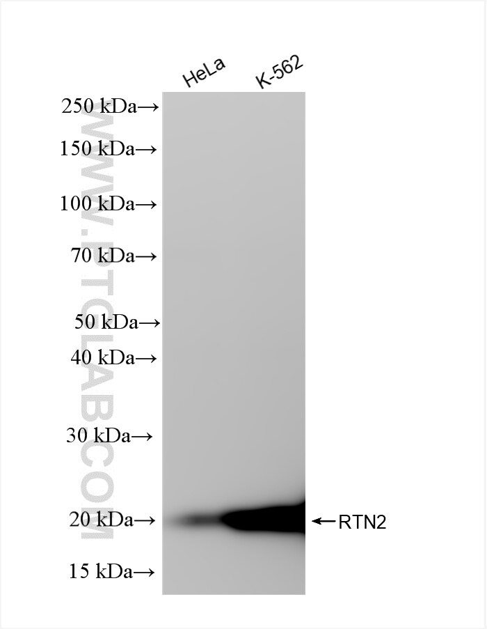 Western Blot (WB) analysis of various lysates using RTN2 Recombinant antibody (86162-1-RR)
