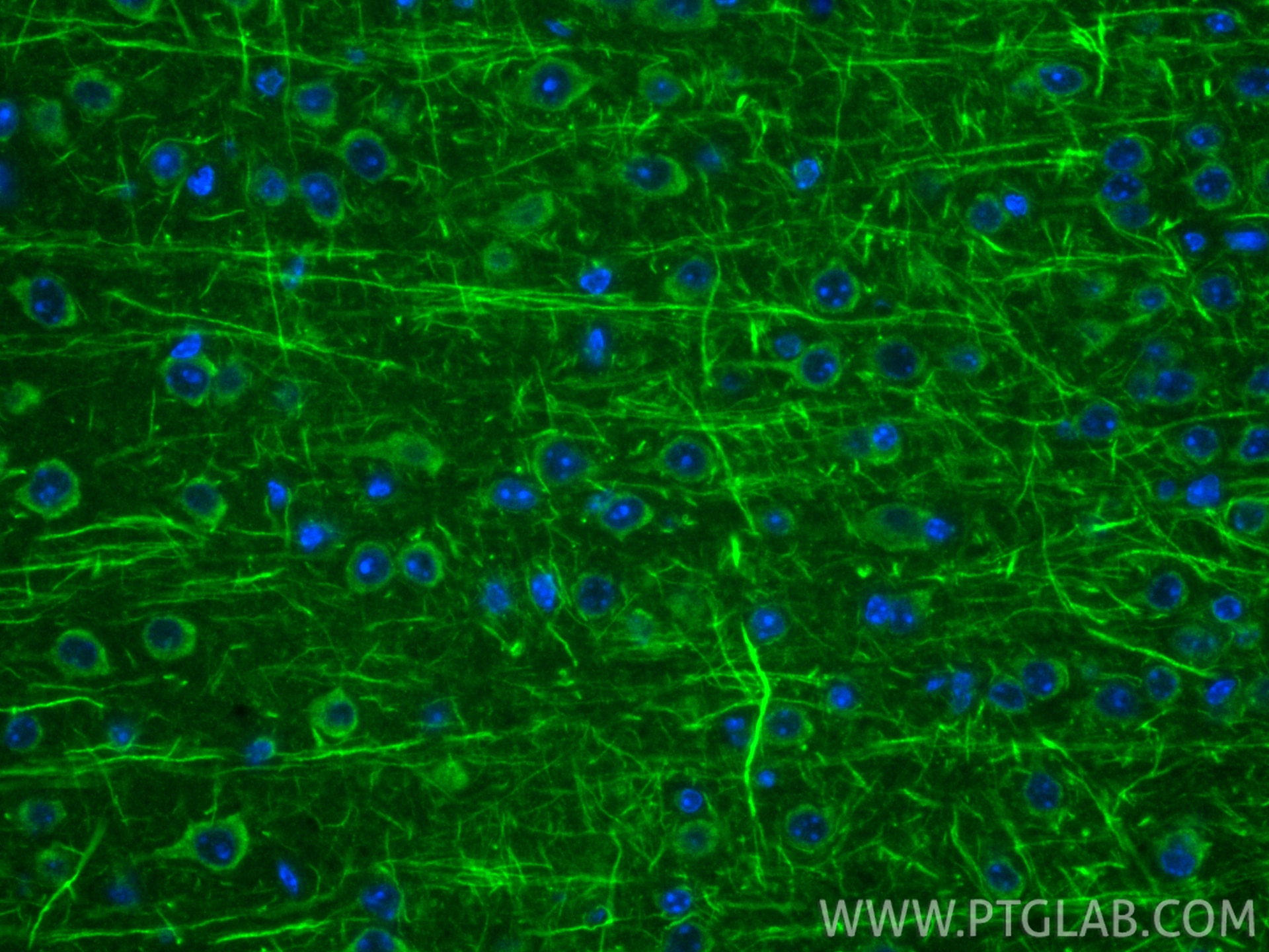 IF Staining of mouse brain using 12055-2-AP Immunofluorescence (IF) / fluorescent staining of mouse brain tissue using RTN3 Polyclonal antibody (12055-2-AP)