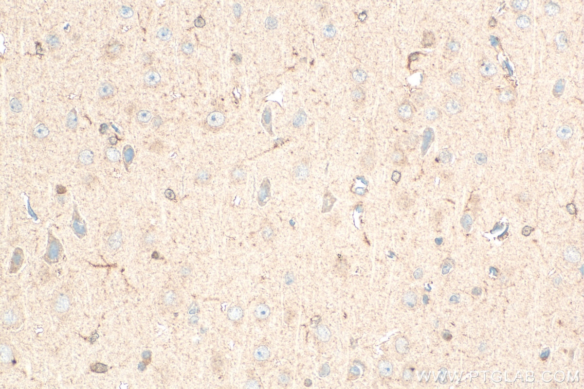 IHC staining of rat brain using 12055-2-AP Immunohistochemistry (IHC) staining of rat brain tissue using RTN3 Polyclonal antibody (12055-2-AP)