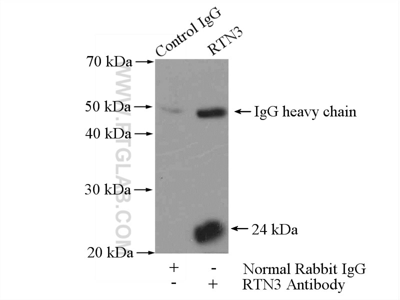 Immunoprecipitation (IP) experiment of HeLa cells using RTN3 Polyclonal antibody (12055-2-AP)