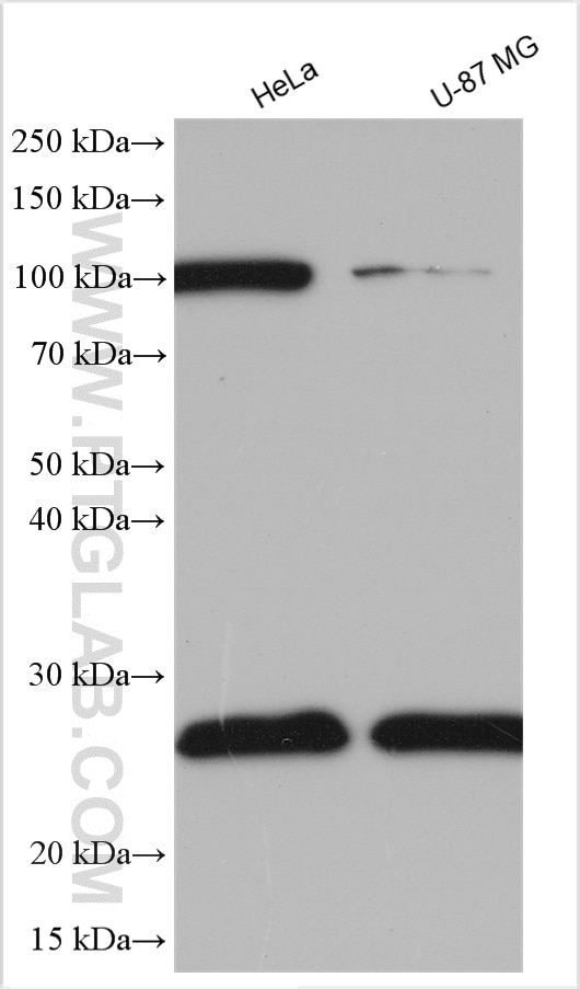 Western Blot (WB) analysis of various lysates using RTN3 Polyclonal antibody (12055-2-AP)