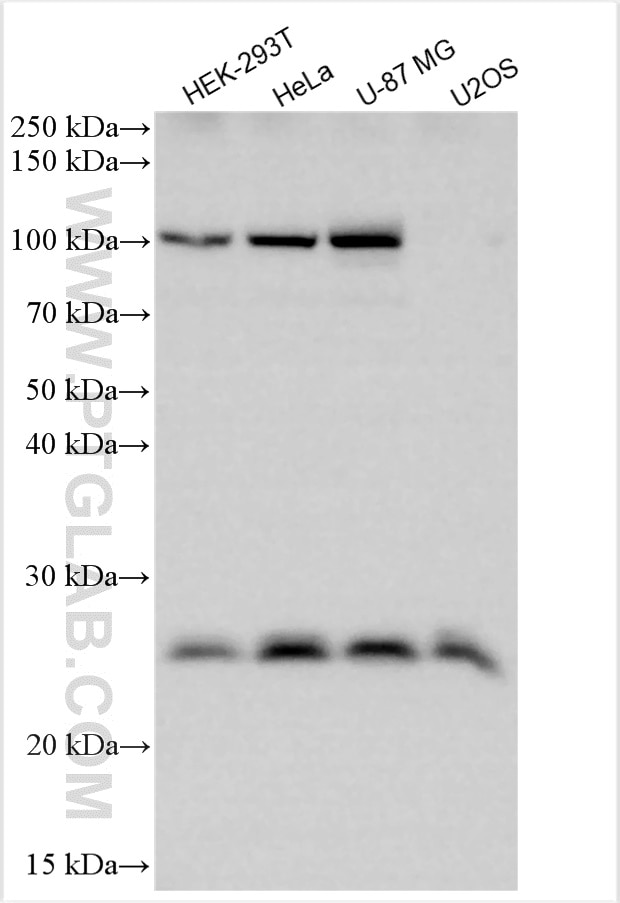 Western Blot (WB) analysis of various lysates using RTN3 Polyclonal antibody (12055-2-AP)