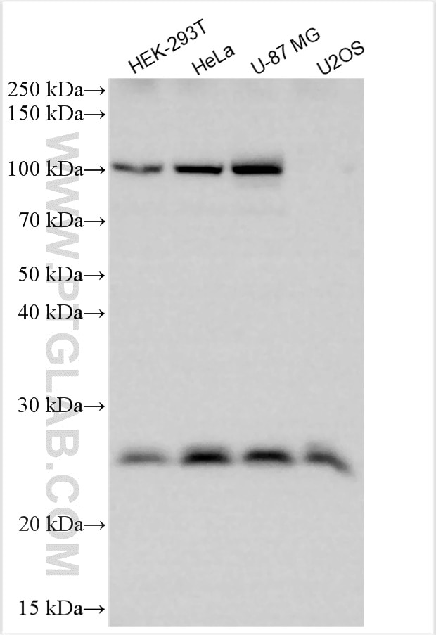 WB analysis using 12055-2-AP