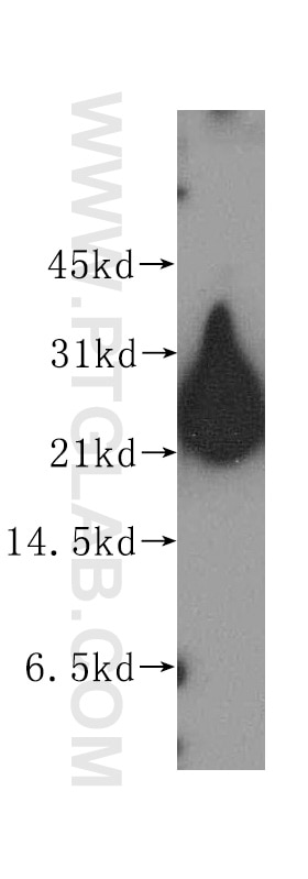 Western Blot (WB) analysis of human brain tissue using RTN3 Polyclonal antibody (12055-2-AP)