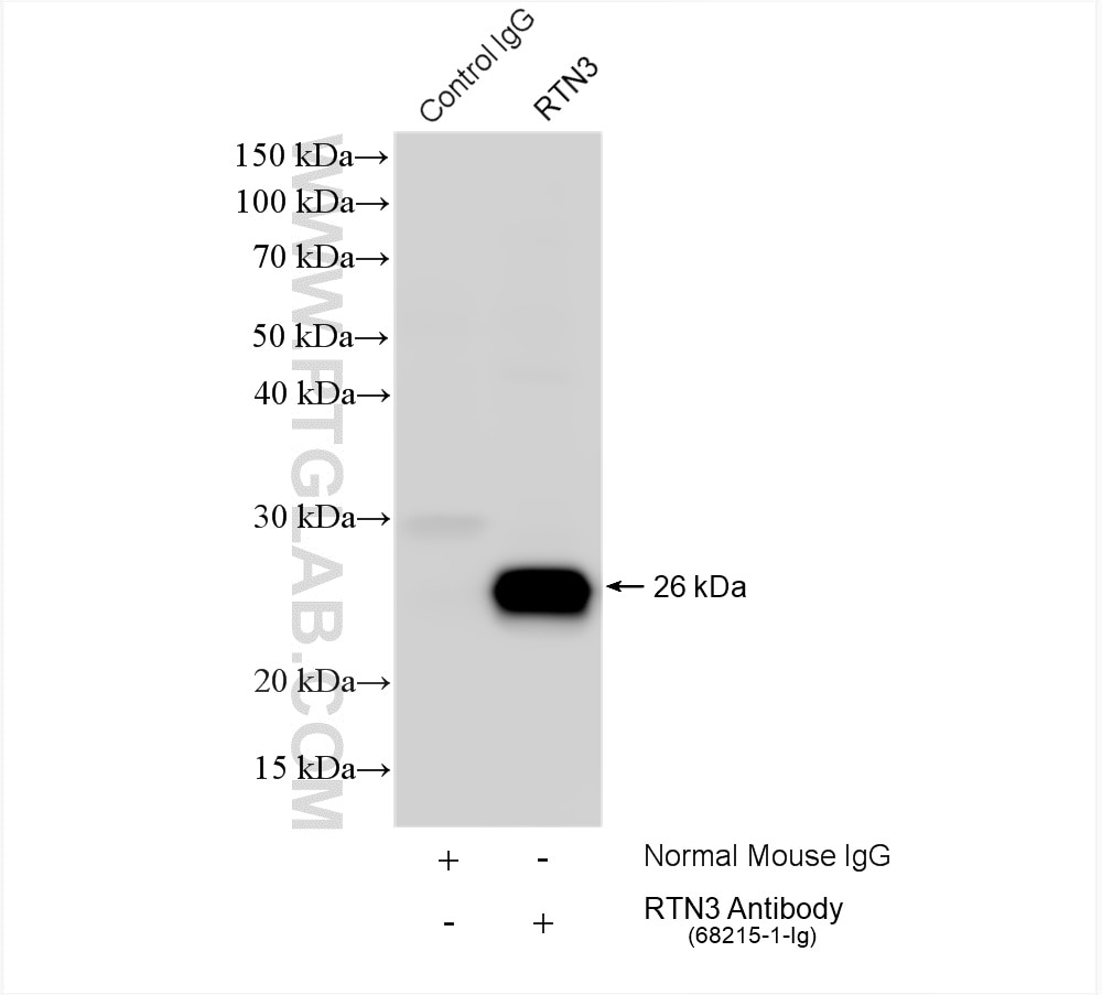 Immunoprecipitation (IP) experiment of A549 cells using RTN3 Monoclonal antibody (68215-1-Ig)