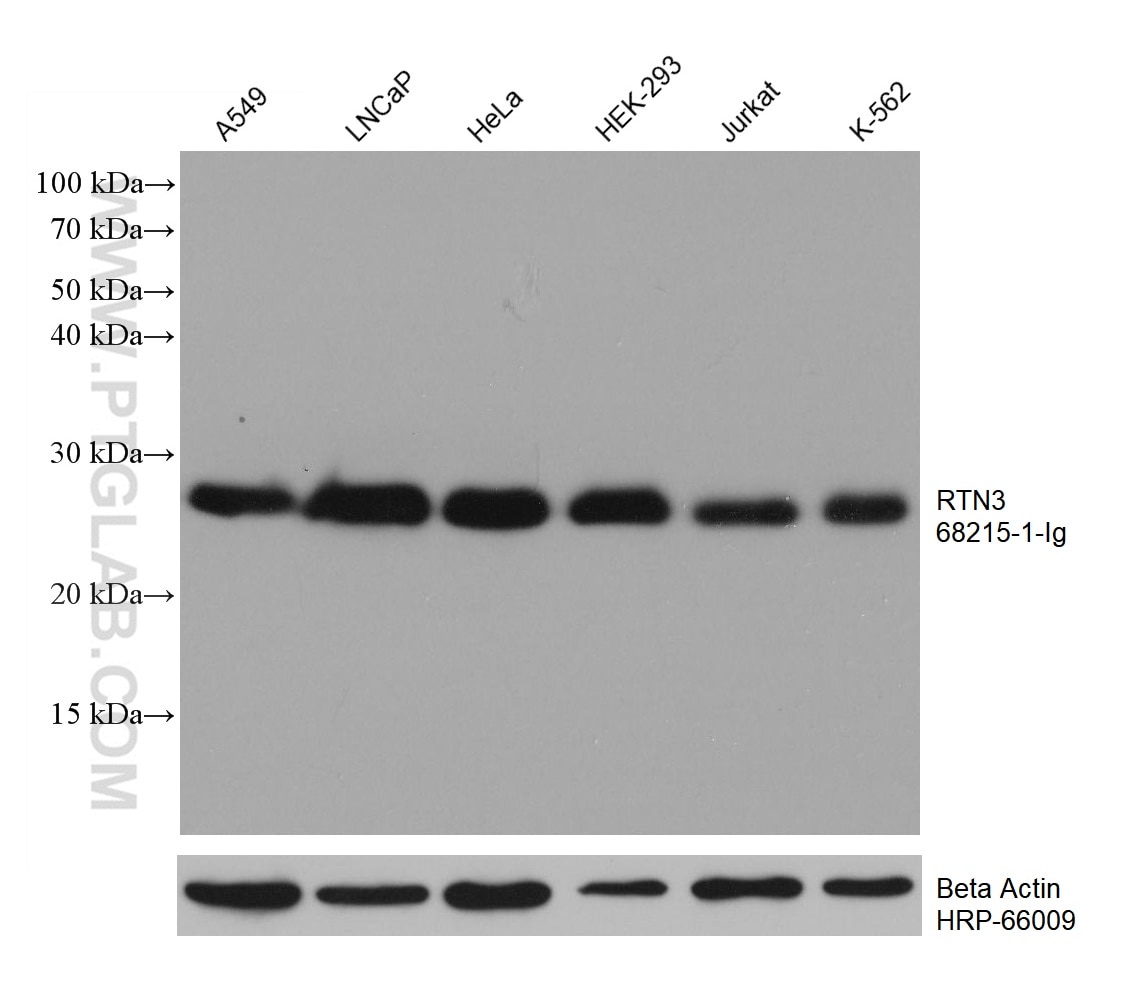 WB analysis using 68215-1-Ig