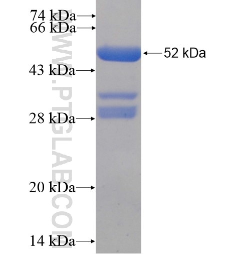 RTN3 fusion protein Ag2685 SDS-PAGE