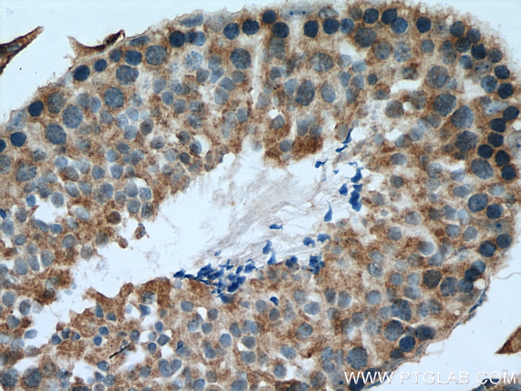 Immunohistochemistry (IHC) staining of mouse testis tissue using RTN4/NOGO Polyclonal antibody (10740-1-AP)