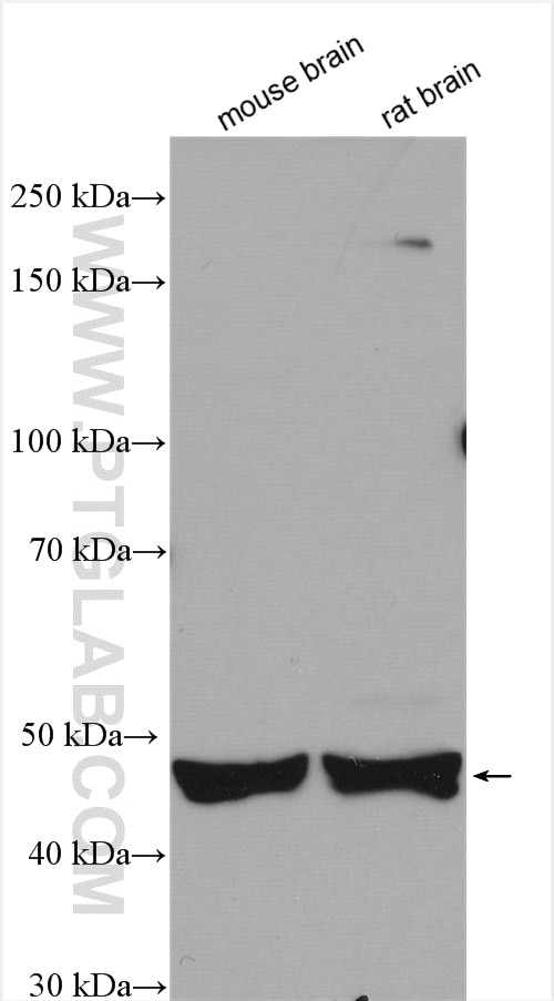 Western Blot (WB) analysis of various lysates using RTN4/NOGO Polyclonal antibody (10740-1-AP)