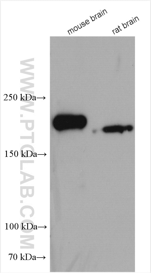 Western Blot (WB) analysis of various lysates using RTN4/NOGO Polyclonal antibody (10740-1-AP)