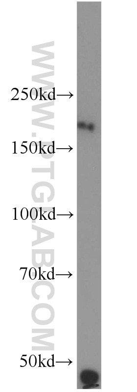 RTN4/NOGO Polyclonal antibody