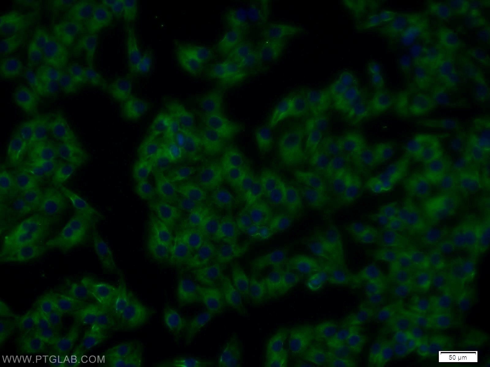 Immunofluorescence (IF) / fluorescent staining of A375 cells using RTN4/NOGO Polyclonal antibody (10950-1-AP)