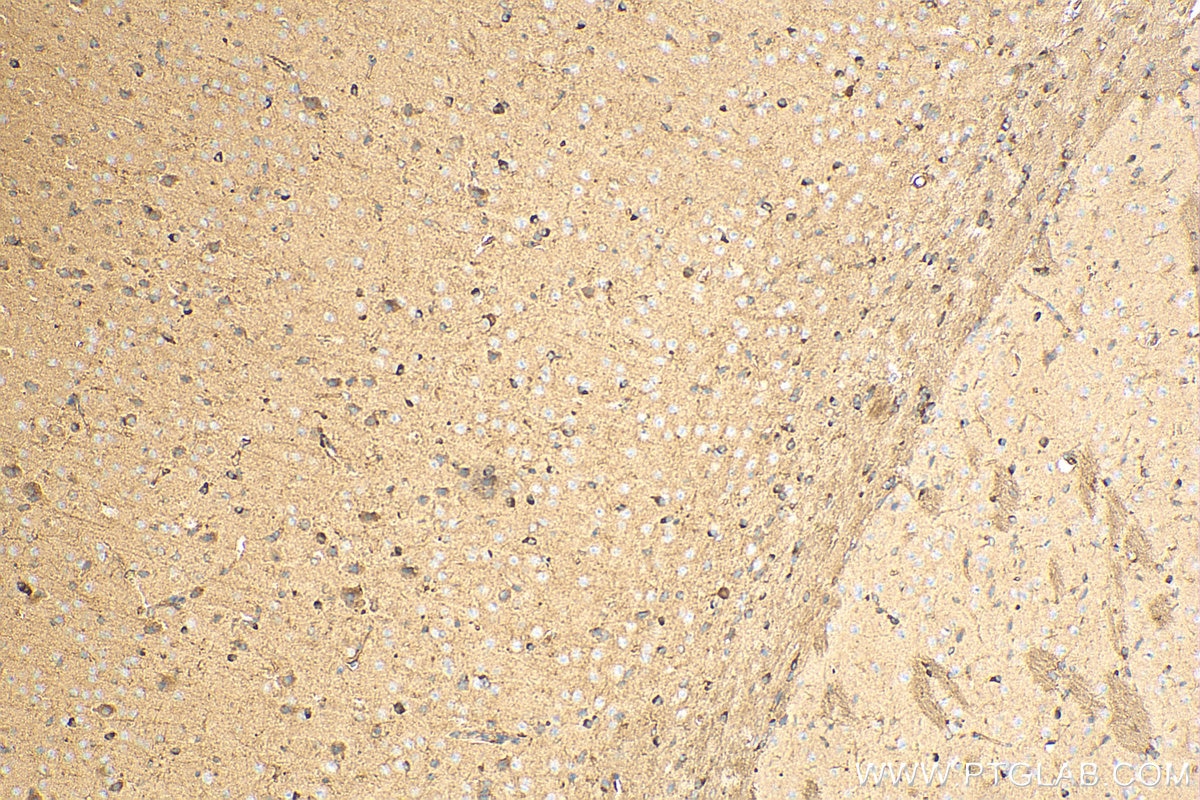 Immunohistochemistry (IHC) staining of mouse brain tissue using RTN4/NOGO Polyclonal antibody (10950-1-AP)