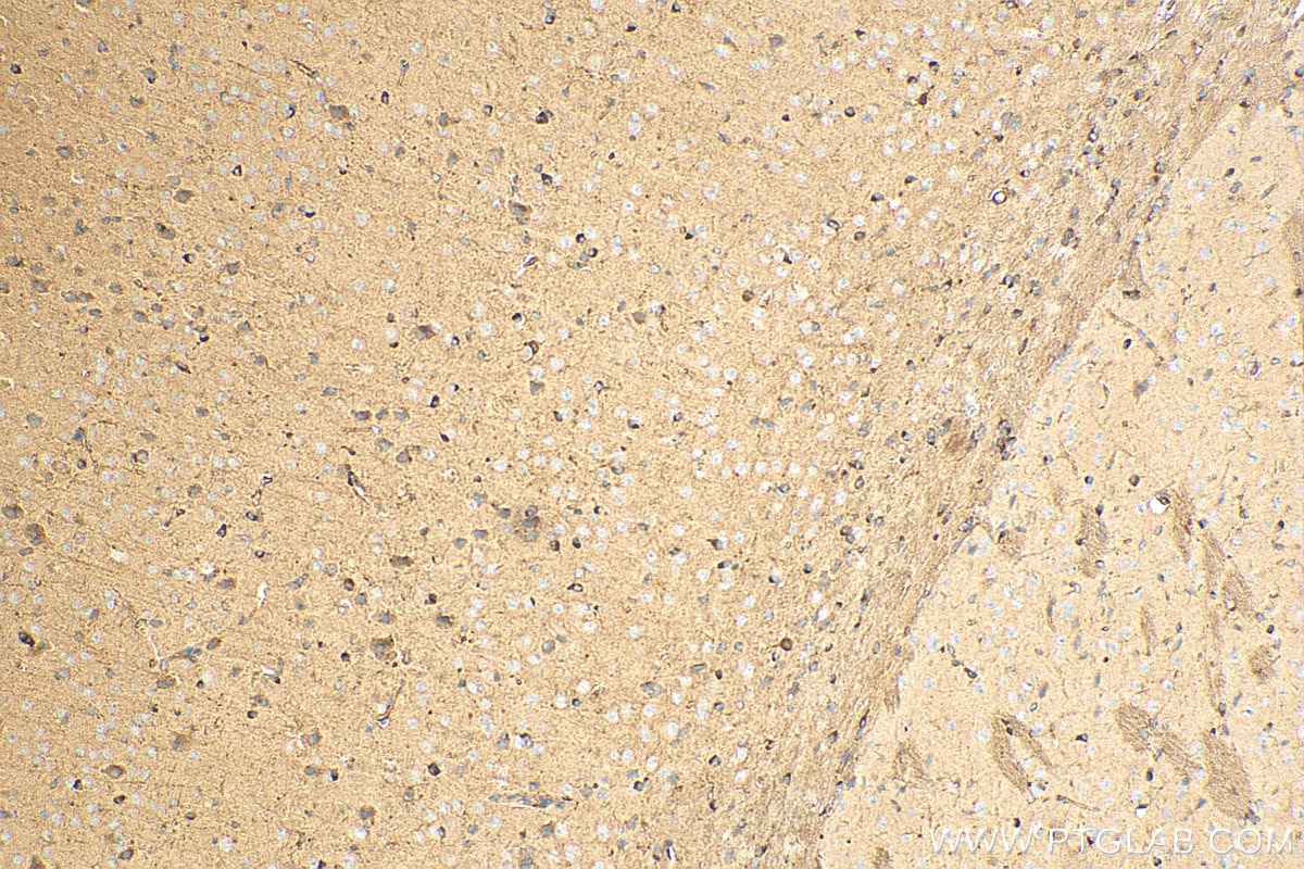 Immunohistochemistry (IHC) staining of mouse brain tissue using RTN4/NOGO Polyclonal antibody (10950-1-AP)