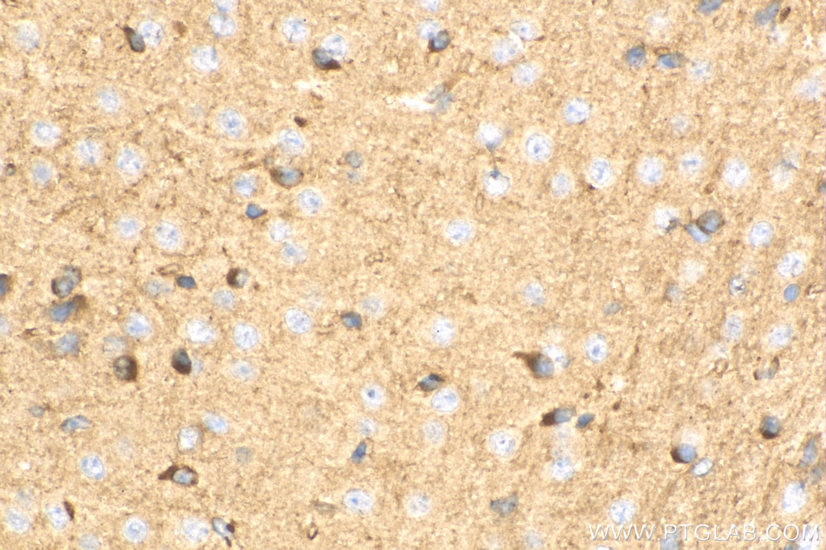 Immunohistochemistry (IHC) staining of mouse brain tissue using RTN4/NOGO Polyclonal antibody (10950-1-AP)