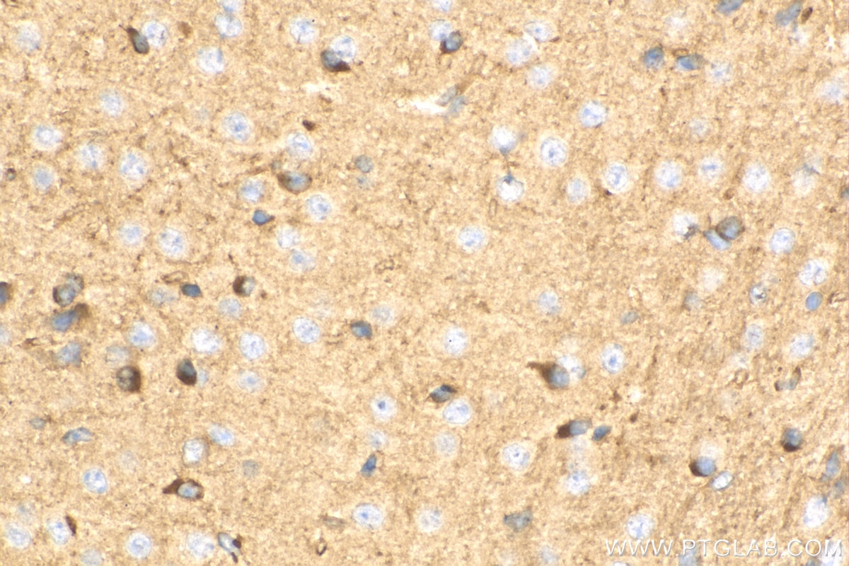 IHC staining of mouse brain using 10950-1-AP