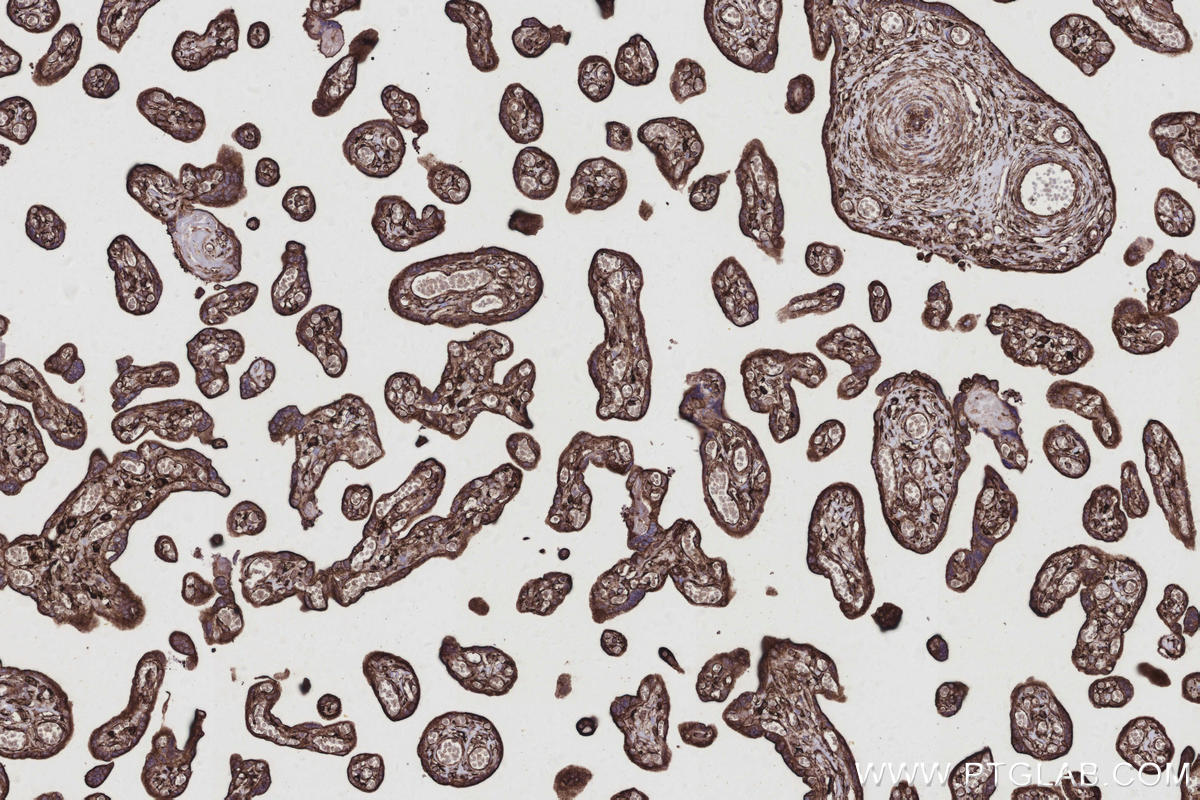IHC staining of human placenta using 10950-1-AP Immunohistochemistry (IHC) staining of human placenta tissue using RTN4/NOGO Polyclonal antibody (10950-1-AP)