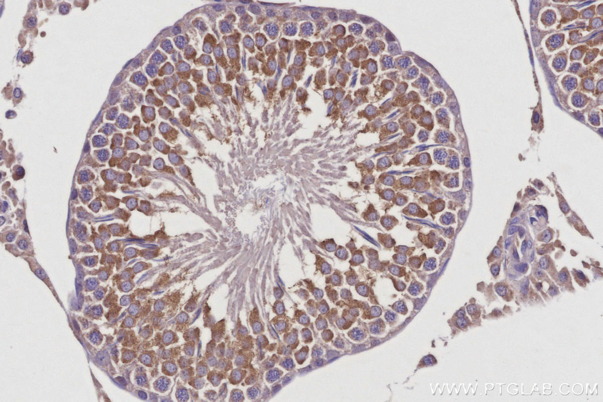 IHC staining of rat testis using 10950-1-AP Immunohistochemistry (IHC) staining of rat testis tissue using RTN4/NOGO Polyclonal antibody (10950-1-AP)