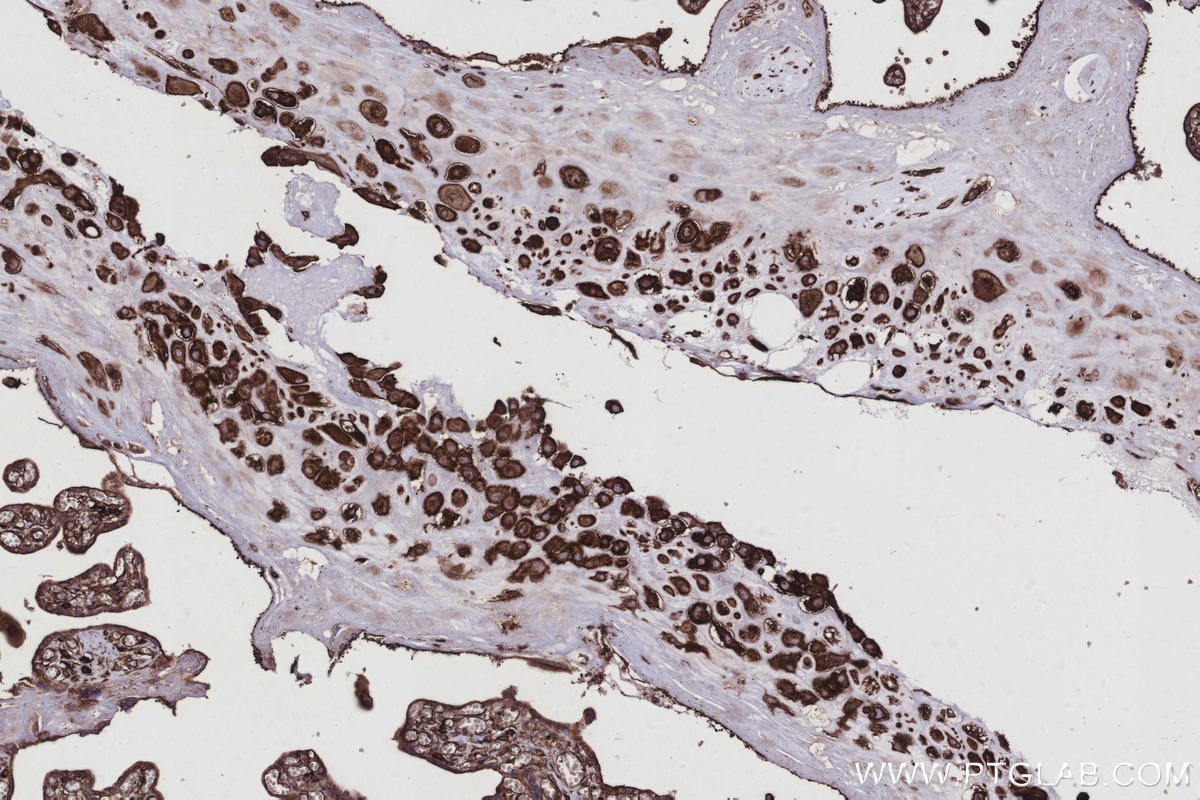 IHC staining of human placenta using 10950-1-AP Immunohistochemistry (IHC) staining of human placenta tissue using RTN4/NOGO Polyclonal antibody (10950-1-AP)