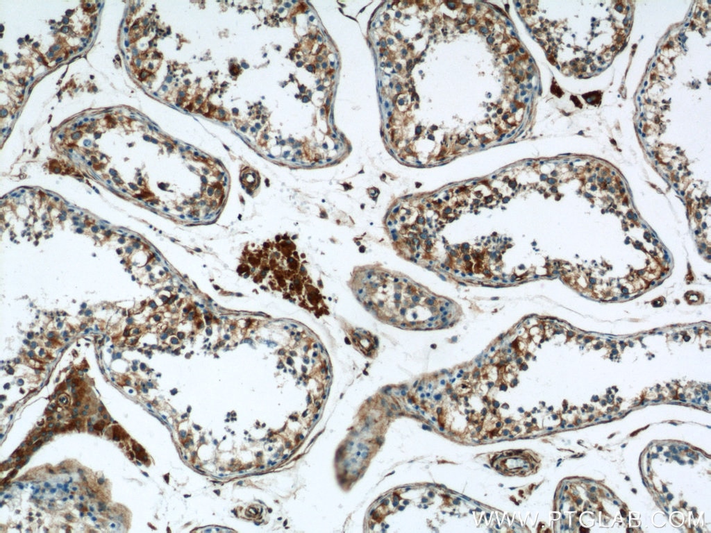 Immunohistochemistry (IHC) staining of human testis tissue using RTN4/NOGO Polyclonal antibody (10950-1-AP)