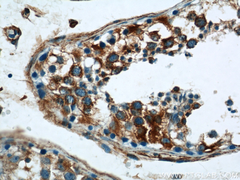 Immunohistochemistry (IHC) staining of human testis tissue using RTN4/NOGO Polyclonal antibody (10950-1-AP)