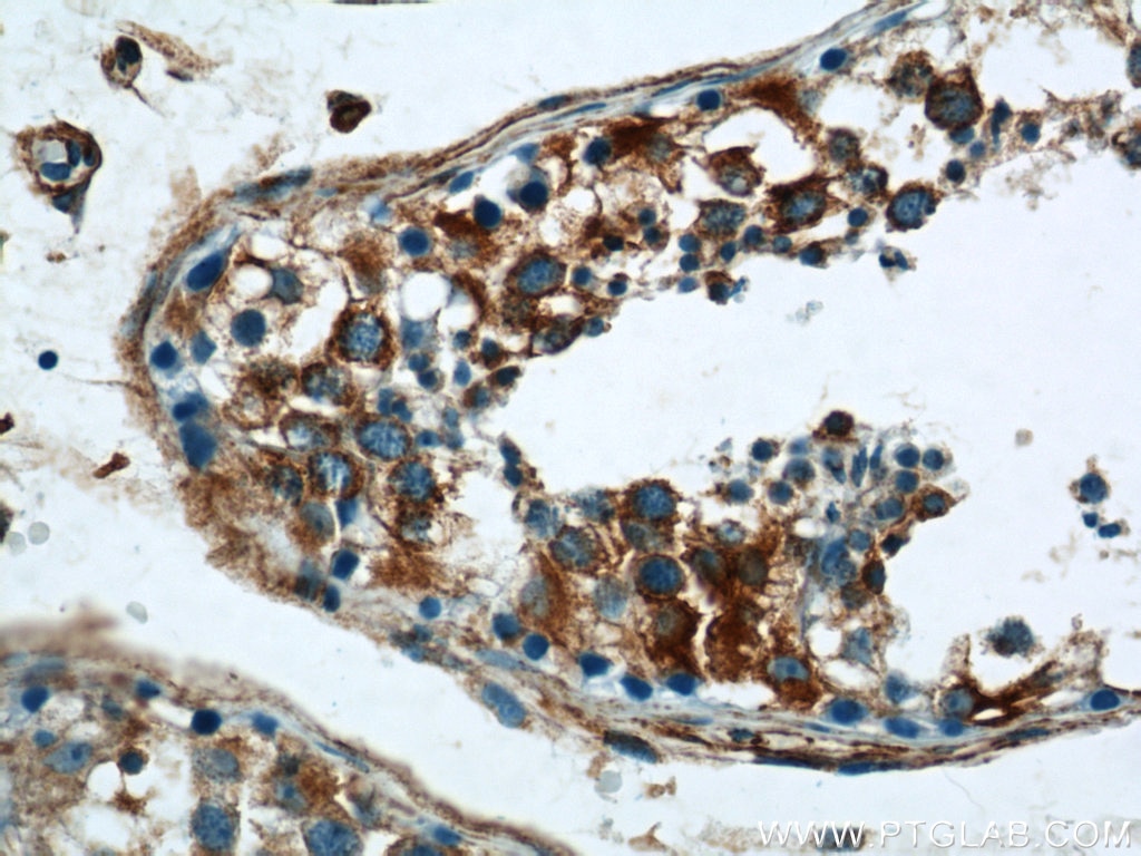 IHC staining of human testis using 10950-1-AP