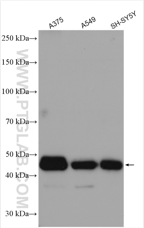 Western Blot (WB) analysis of various lysates using RTN4/NOGO Polyclonal antibody (10950-1-AP)