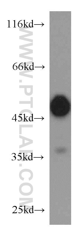 Western Blot (WB) analysis of HepG2 cells using RTN4/NOGO Polyclonal antibody (10950-1-AP)