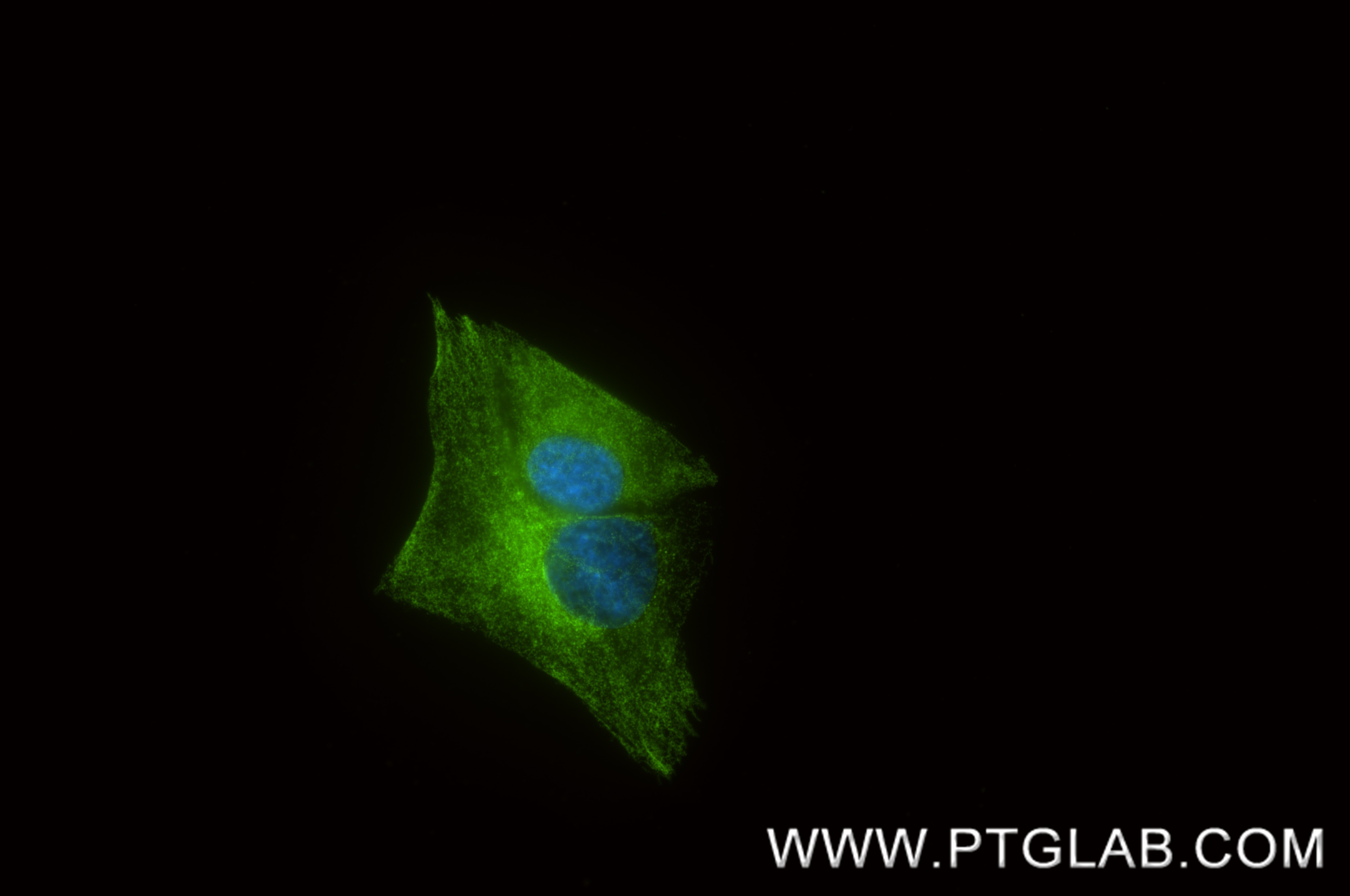 IF Staining of SH-SY5Y using 87573-2-RR Immunofluorescence (IF) / fluorescent staining of SH-SY5Y cells using RTN4/NOGO Recombinant monoclonal antibody (87573-2-RR)