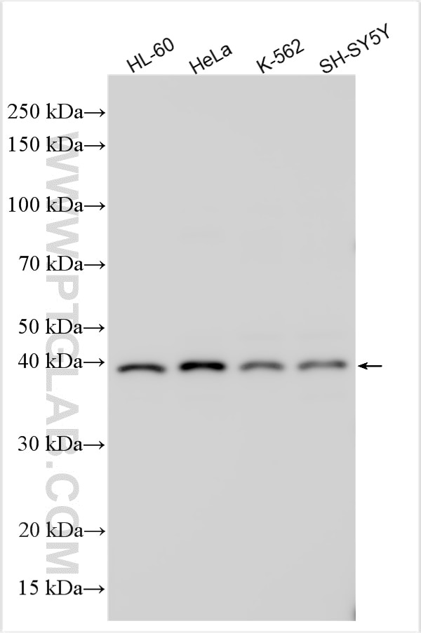 Western Blot (WB) analysis of various lysates using RTN4RL2 Polyclonal antibody (26039-1-AP)