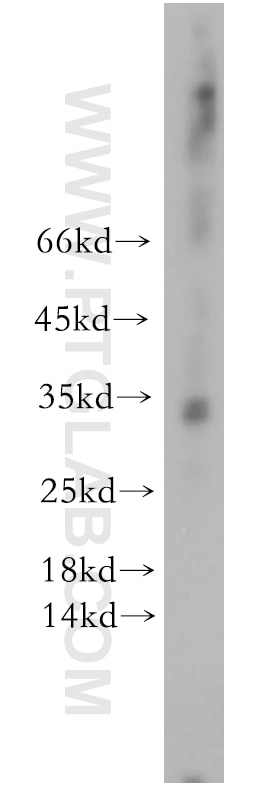 Western Blot (WB) analysis of human brain tissue using RTP1 Polyclonal antibody (18973-1-AP)