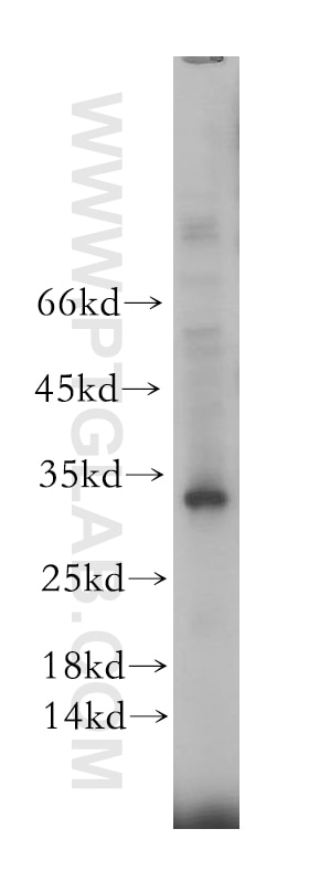 Western Blot (WB) analysis of HEK-293 cells using RTP1 Polyclonal antibody (18973-1-AP)