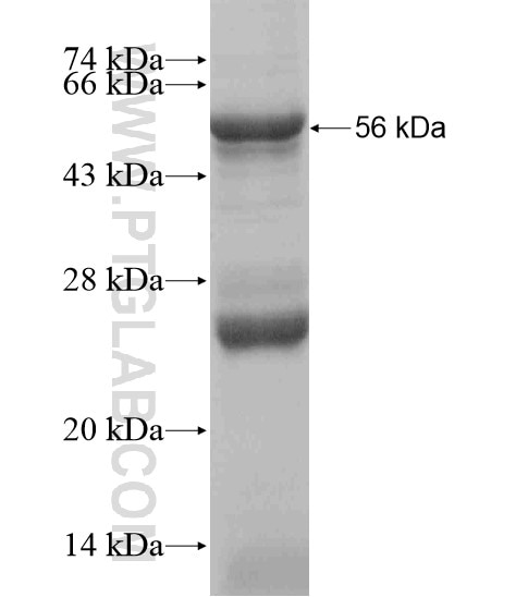 RTP3 fusion protein Ag18958 SDS-PAGE