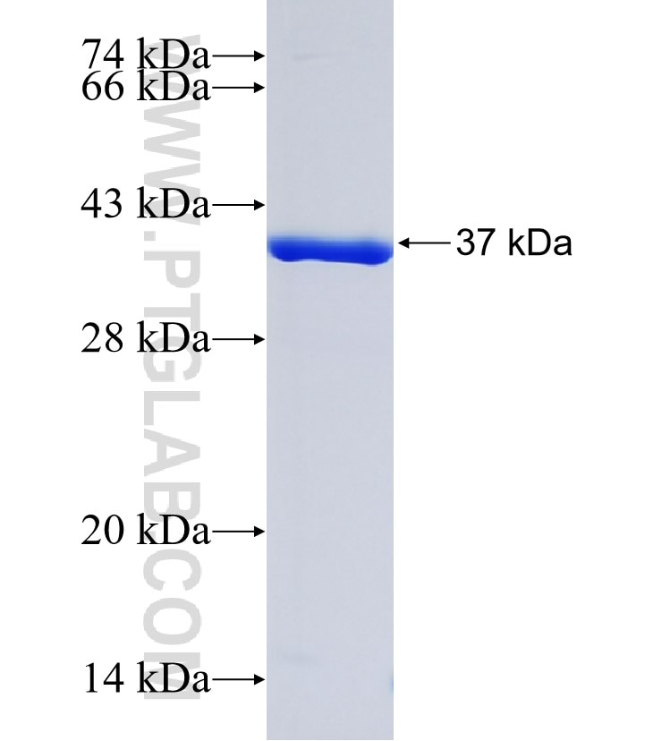 RTTN fusion protein Ag34960 SDS-PAGE