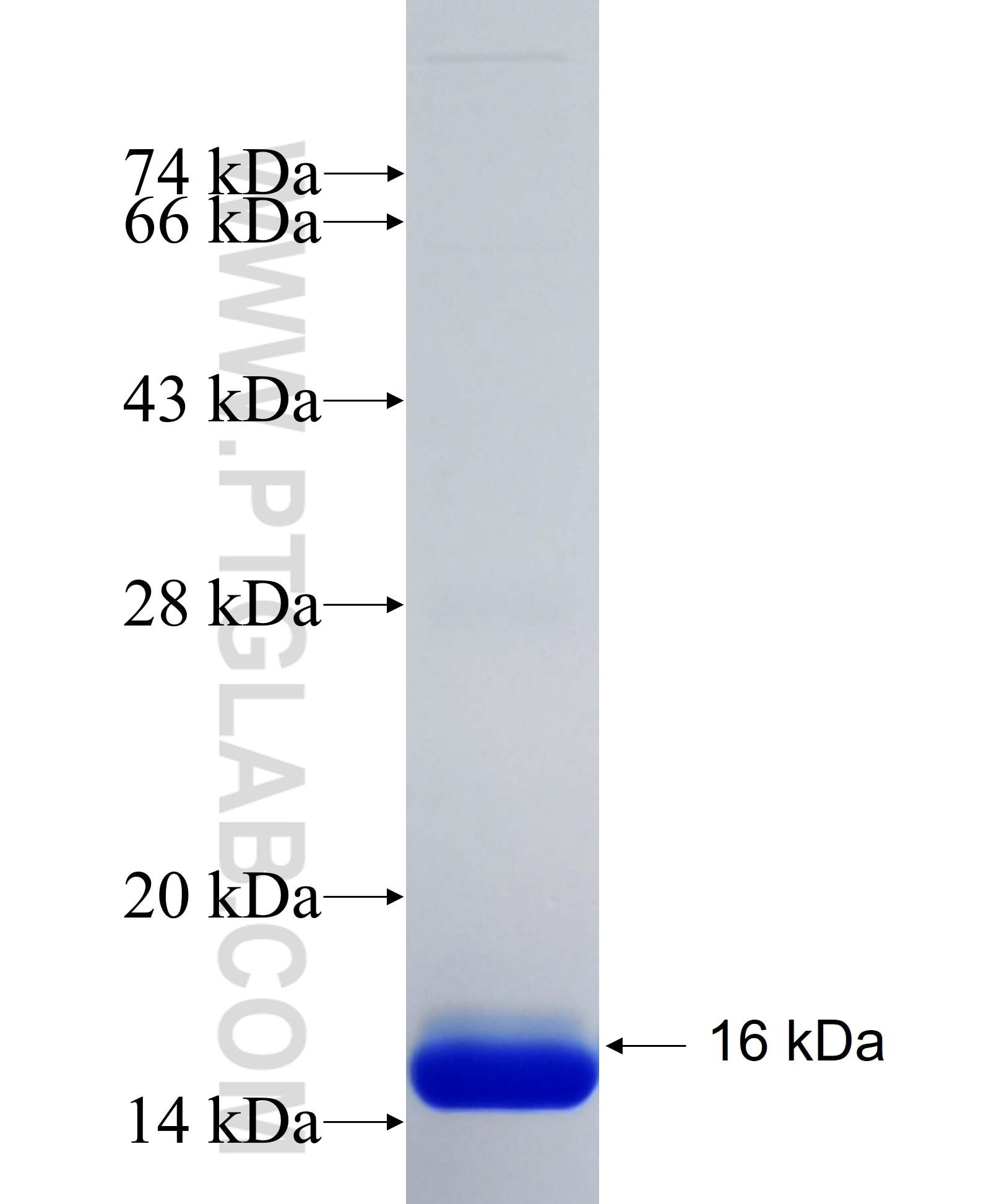 RTTN fusion protein Ag34988 SDS-PAGE