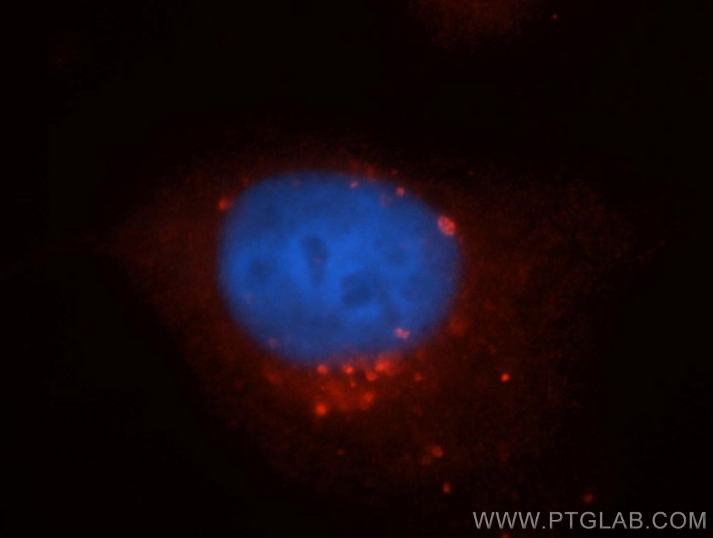 Immunofluorescence (IF) / fluorescent staining of HeLa cells using RUFY1 Polyclonal antibody (13498-1-AP)
