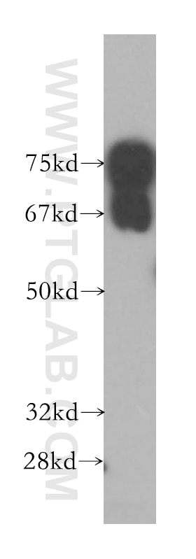 Western Blot (WB) analysis of HeLa cells using RUFY1 Polyclonal antibody (13498-1-AP)