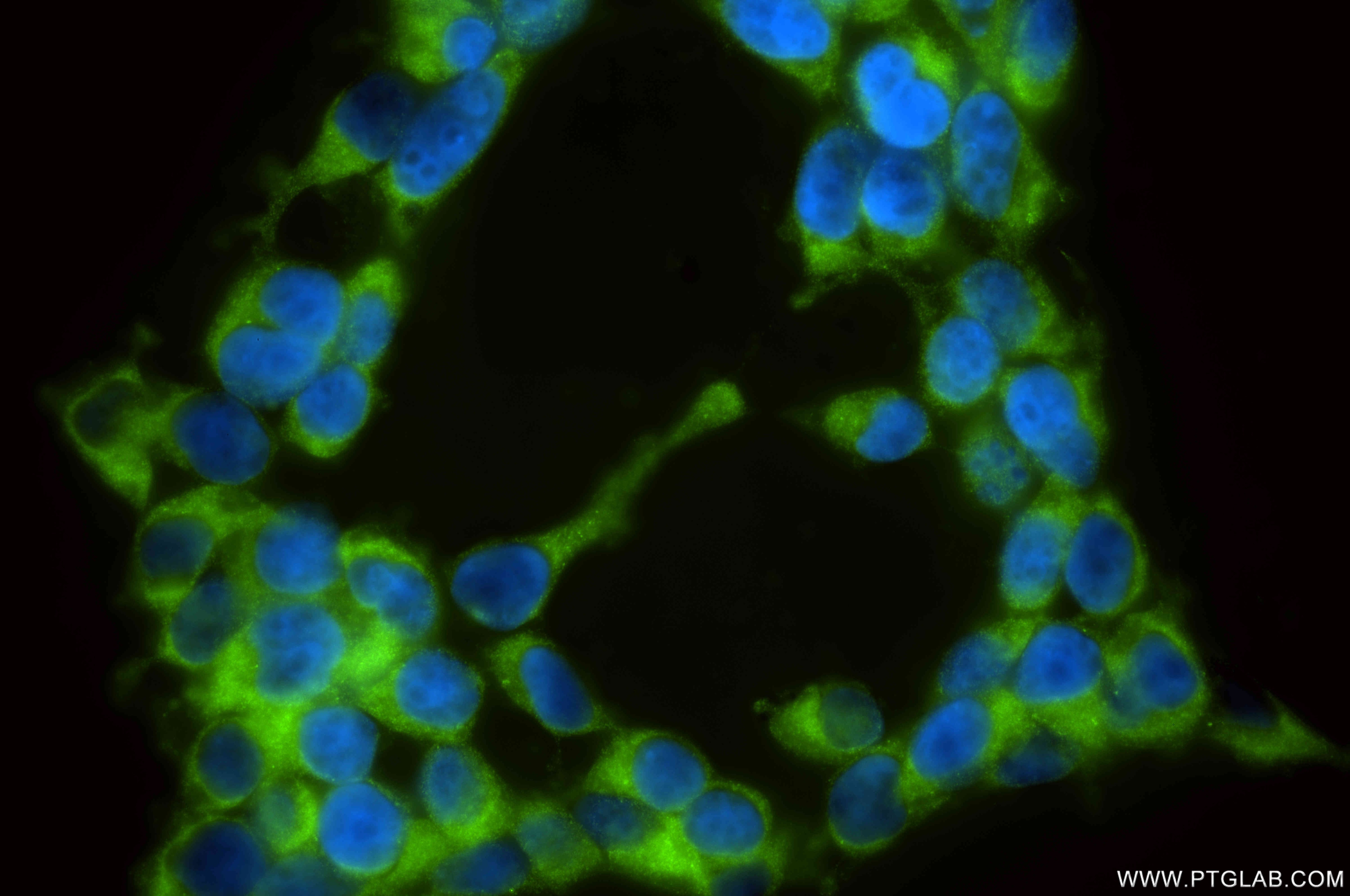 Immunofluorescence (IF) / fluorescent staining of HEK-293 cells using RUFY1 Recombinant antibody (85839-4-RR)
