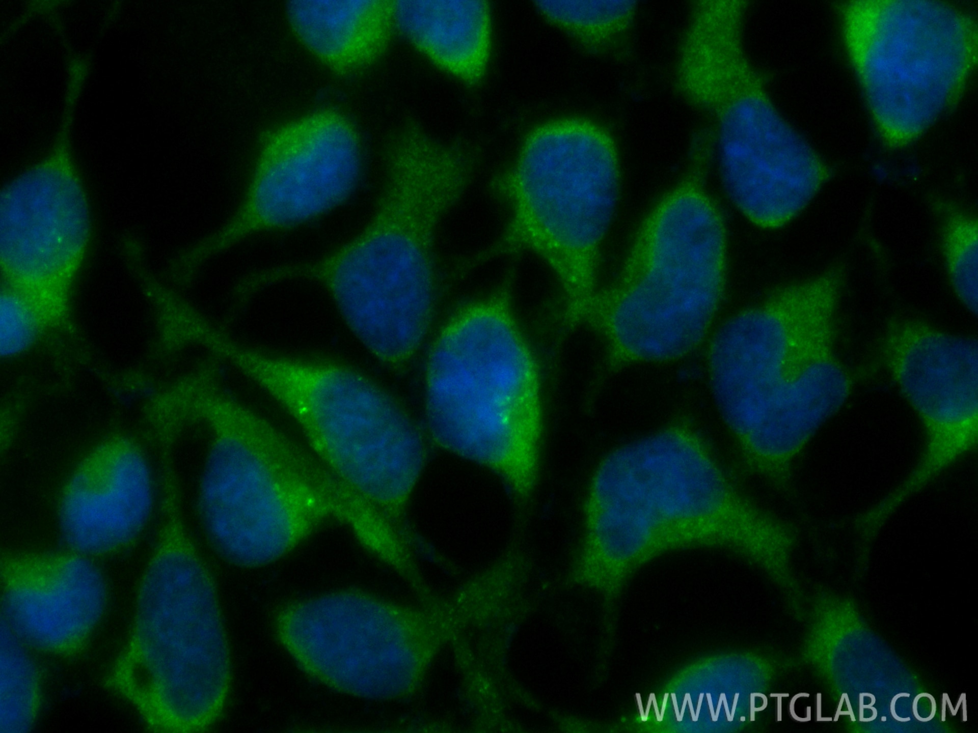 IF Staining of HEK-293 using CL488-85839-4 Immunofluorescence (IF) / fluorescent staining of HEK-293 cells using CoraLite® Plus 488-conjugated RUFY1 Recombinant mo (CL488-85839-4)