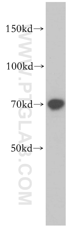 Western Blot (WB) analysis of PC-3 cells using RUFY2 Polyclonal antibody (14137-1-AP)