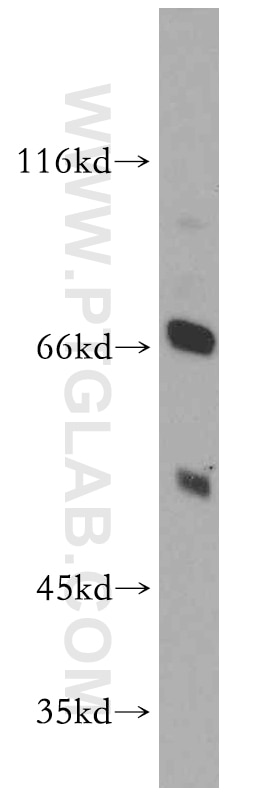 Western Blot (WB) analysis of mouse lung tissue using RUFY2 Polyclonal antibody (14137-1-AP)