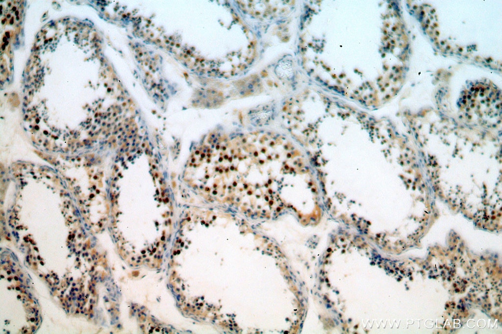 Immunohistochemistry (IHC) staining of human testis tissue using RUFY2 Polyclonal antibody (19180-1-AP)