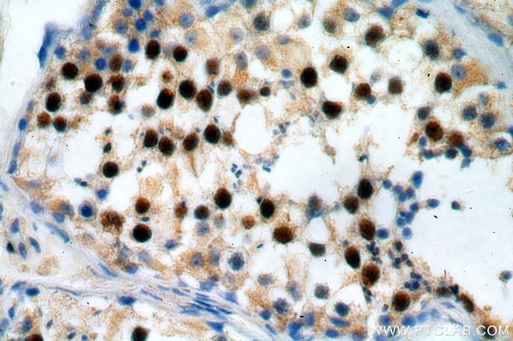 Immunohistochemistry (IHC) staining of human testis tissue using RUFY2 Polyclonal antibody (19180-1-AP)